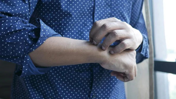 Allergie alimentari: tutto quello che devi sapere su cause, sintomi e rimedi