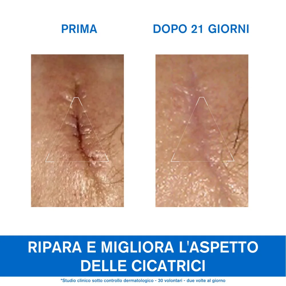 Uriage Barièderm Cica-Crema Riparatrice al Cu-Zn 40 ml 