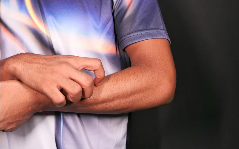 Irritazione cutanea: cause, sintomi e rimedi per pelle arrossata e prurito