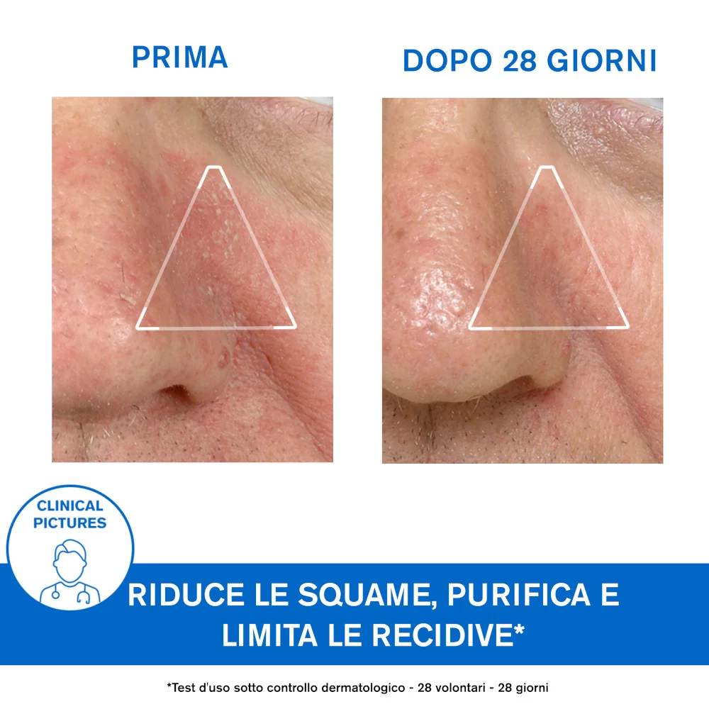 Uriage DS Emulsione Trattamento Regolatore Pelle Irritata 40 ml Idratazione Profonda