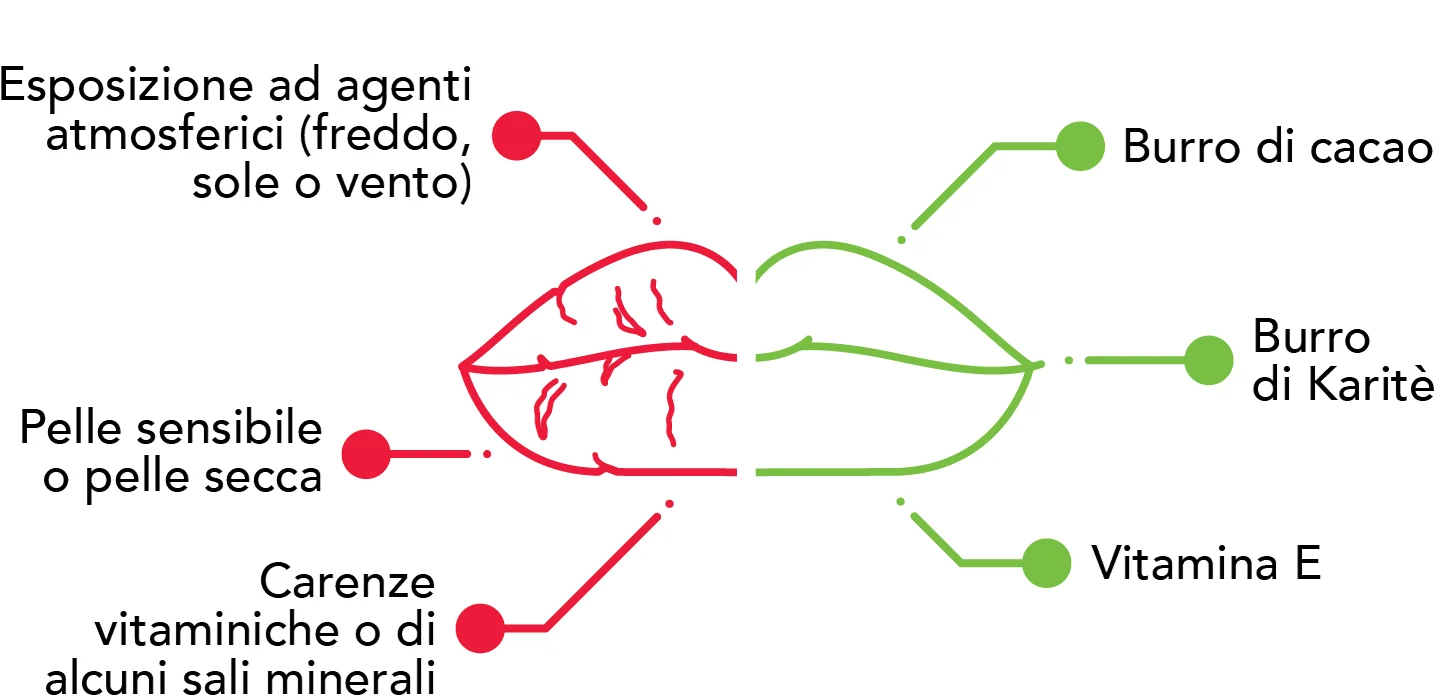 rimedi per labbra screpolate